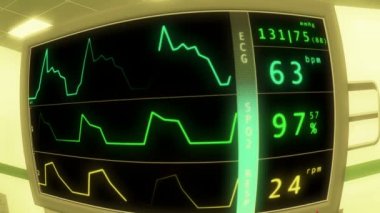Operasyon odasında EKG monitör