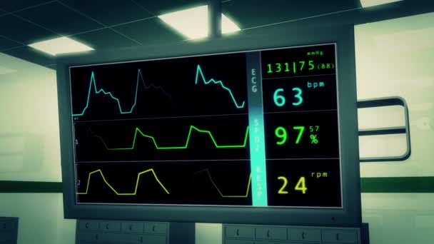 Monitor EKG en sala de operaciones — Vídeos de Stock