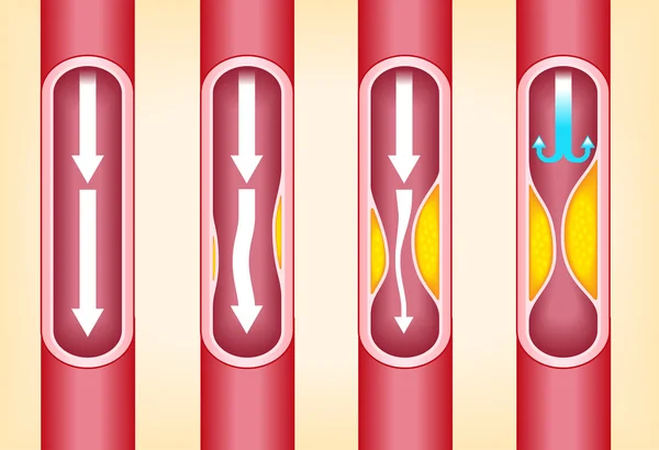 Four red arteriers — Stock Vector