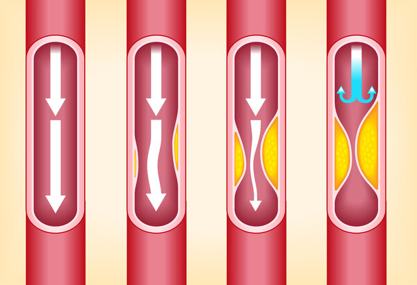 четыре красные артерии
