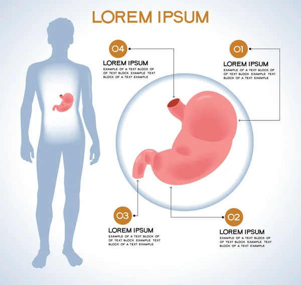 Stomaco. Infografica medica moderna . — Vettoriale Stock