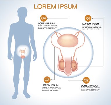 Penis. Modern tıbbi infographics. 