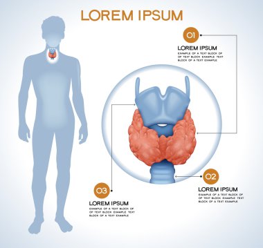 Tiroid. Modern tıbbi infographics. 