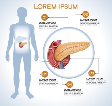 Pankreas. Modern tıbbi infographics.  