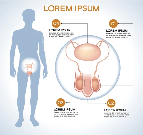 Penis. moderne medizinische Infografiken. — Stockvektor