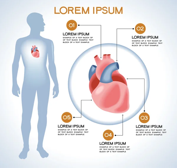 Cuore. Infografica medica moderna . — Vettoriale Stock