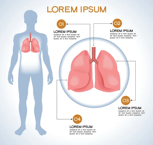 RGBLung. Infografías médicas modernas . — Vector de stock