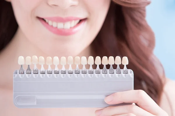 Young woman  teeth sample — Stock Photo, Image