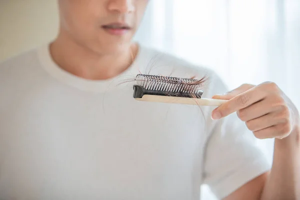 Asian Man Worry His Receding Hairline Look Hairbrush Many Hair — Fotografia de Stock