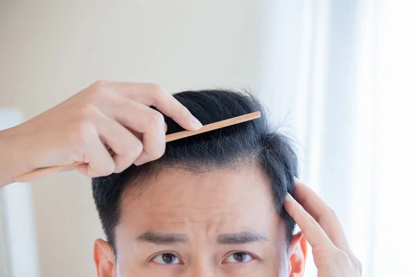 Nahaufnahme Von Erschöpften Asiatischen Mann Bürsten Seine Haare Mit Kamm Stockbild