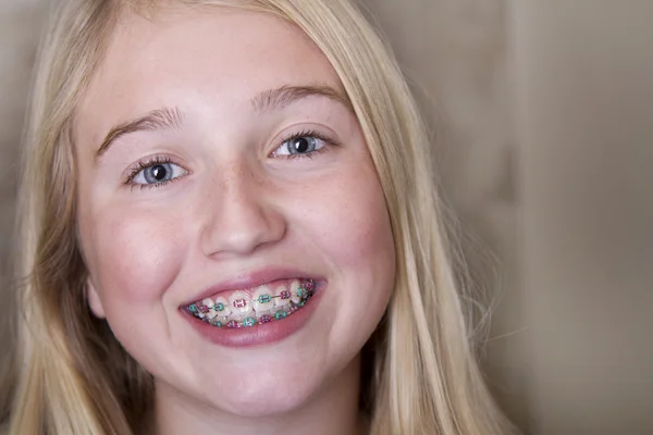 Menina adolescente com aparelho nos dentes — Fotografia de Stock