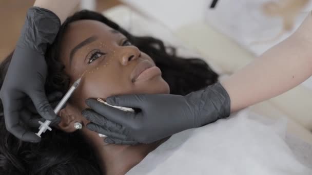 Primo piano delle mani del medico cosmetologo che effettua la procedura di iniezione facciale ringiovanente per stringere e levigare le rughe sulla pelle del viso intorno agli occhi per la bella giovane donna africana — Video Stock