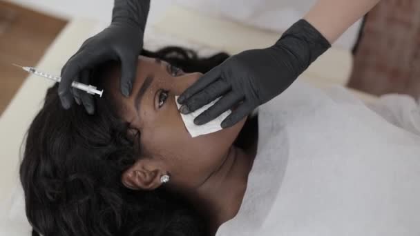 Detailní záběr ženské kosmetolog lékař ruce v černých rukavicích otírání kapky injekcí biorevitalizace u pěkné africké ženy tvář kůže kolem oka. Mezoterapie a zvedání obličeje na kosmetické klinice — Stock video