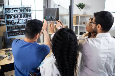 Modern klinikte ya da hastanede röntgen taraması yapan dört tane çok ırklı doktor var.