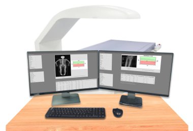 Kemik yoğunluğunu, tüm vücut ve bileği kapatın, osteoporoz semptomlarını teşhis etmek için kullanılan hastanenin röntgen bölümü. Yüzey bulanık görüntüsü ve görüntü aşırı gürültü, film tahılları içeriyor.