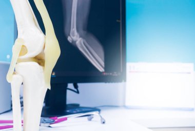 Tıbbi eğitim için steteskoplu insan dizi ve bacağı modeli ve klinikteki LCD mornitor 'da dizinin röntgeni..