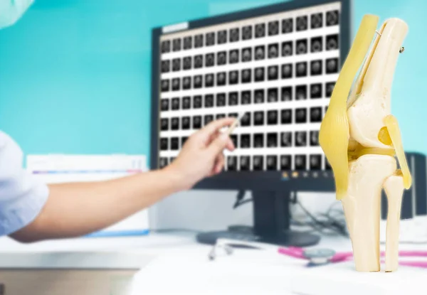 Modelo Rodilla Pierna Humana Con Estetoscopio Mesa Blanca Para Educación — Foto de Stock