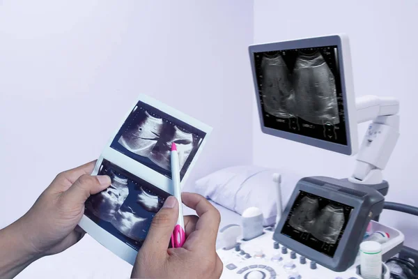 El doktorunun elinde ultrason tutması karaciğer, GB, CBD, pankreas, dalak ve her iki böbreğin de normal olduğunu gösteriyor..