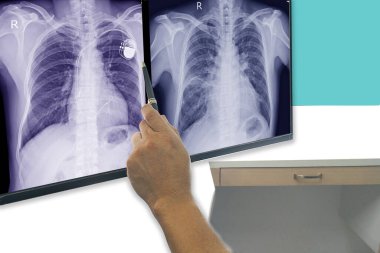 Müzik sesi için yumuşak ve bulanık kulaklıklar. Gri arkaplanda izole