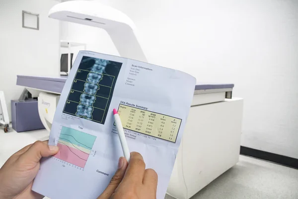 (DEXA densitometri omurga taraması. Osteoporia mevcut, kemik yoğunluğu makinesi arkaplanındaki kalem noktasında sıkça osteoporozun öncüsü. Tıbbi sağlık konsepti