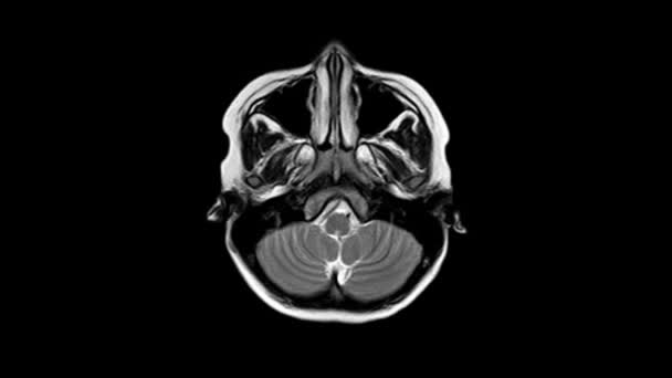 Összefüggés egy CT-vel az agyával. Orvosi, tudományos és oktatási MRI agyi háttér. Mágneses rezonanciás képalkotás. — Stock videók