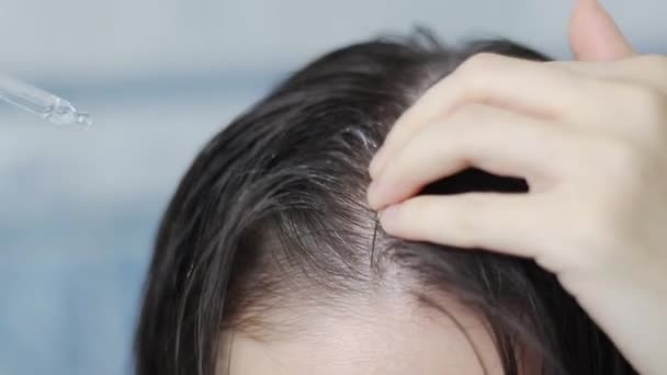 Mujer aplica aceite a las raíces del cabello, el proceso de aplicación de aceite en el cuero cabelludo, la mujer aplica aceite a las raíces del cabello. — Vídeo de stock