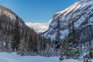 Banff Park 'ta Louise Gölü, Alberta, Kanada