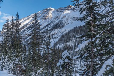 Banff Park 'ta Louise Gölü, Alberta, Kanada