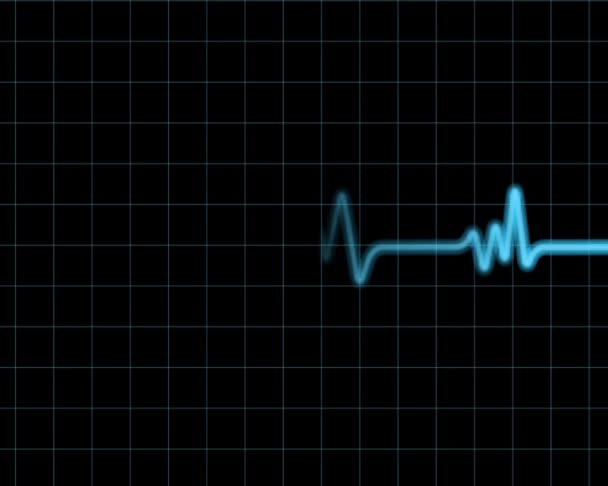 Blue Heart Monitor — Stock Video