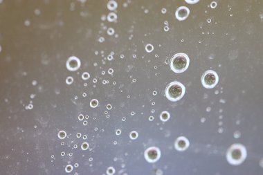 Cama yağmur damlaları düşer.