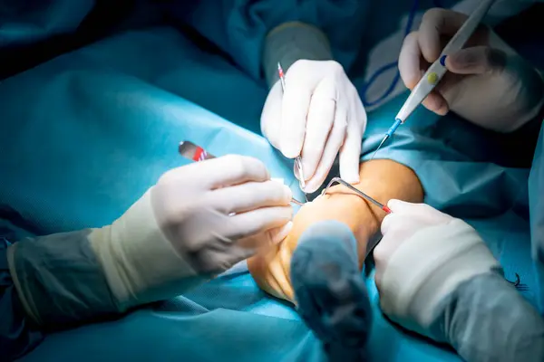 病院で足首手術を行う医師 — ストック写真