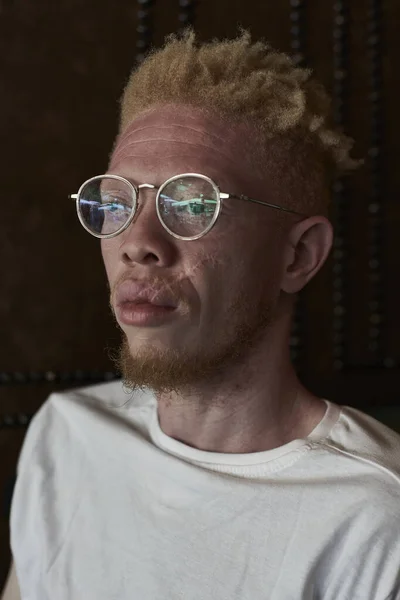 Hombre Albino Con Gafas Redondas Mirando Hacia Los Lados —  Fotos de Stock