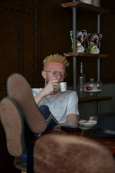 Relaxat Albino Având Cafea Picioarele Masă — Fotografie, imagine de stoc