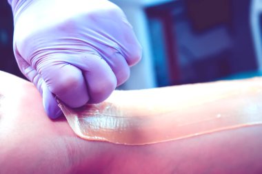 Balmumuyla tüy ayıklama. Shugaring. Balmumu tüyü. Bacağında balmumu şerit var. Kız bacaklarını tüy döküyor. Polimer ağda. Şeker tüy dökücü ustası.