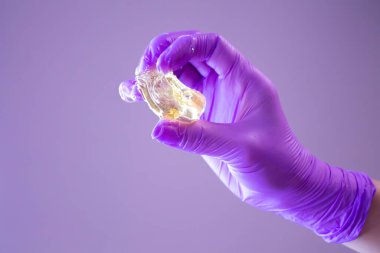 Şekerleme için sıvı şeker. Yatıştırıcı ve sıcak şekerli epilasyon. Elinde bir parça sıcak şeker. Shugaring ustası.