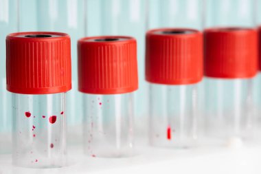 Makro laboratuvar cam test tüpleri ve mavi arka plan üzerinde kan damlaları.