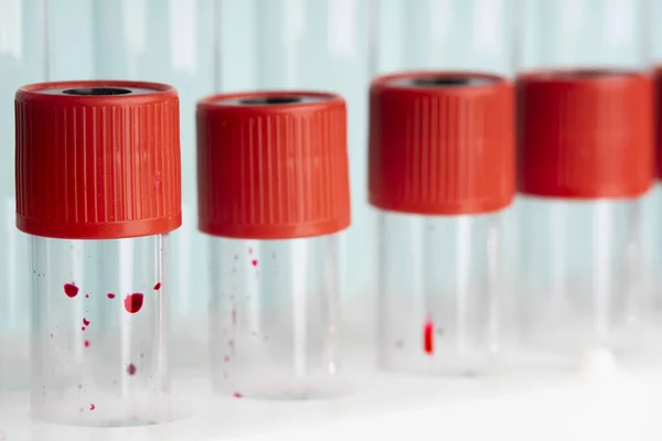 Makro Laboratuvar Cam Test Tüpleri Mavi Arka Plan Üzerinde Kan — Stok fotoğraf