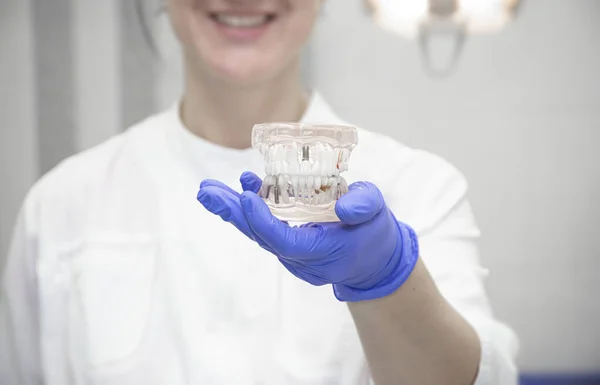 Smiling Dentist Hand Blue Gloves Hold Artificial Model Jaw Implants — 图库照片