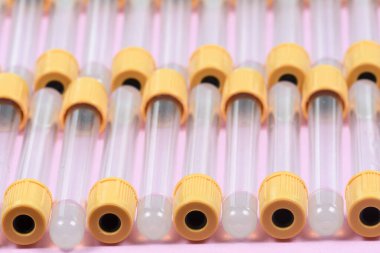 Klinik analiz laboratuvarında kan koleksiyonu için boş vakum tüpü.