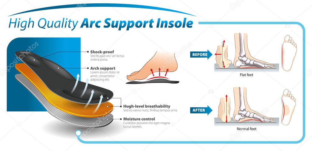 Vector graphic design for three-layered shoe arch support insole -  infographic template.