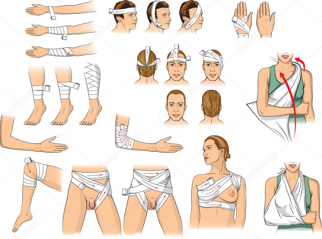 Bandaging techniques