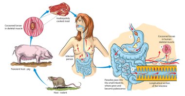 Trichinella clipart