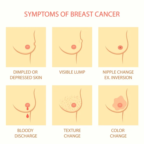 meme kanseri belirtileri cilt,