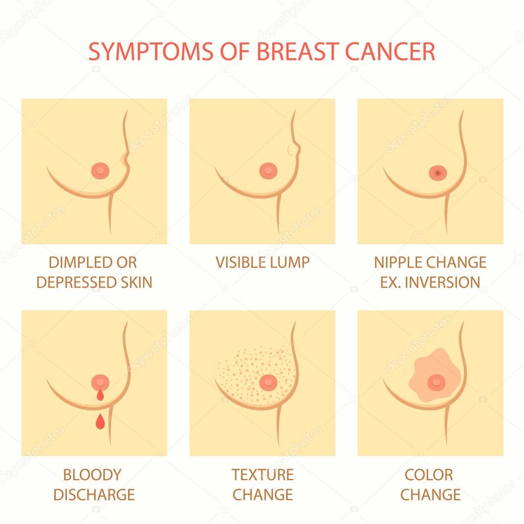 skin symptoms of breast cancer,