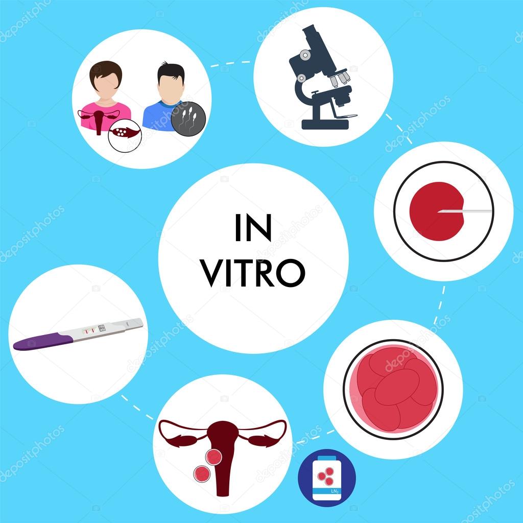 In vitro fertilization