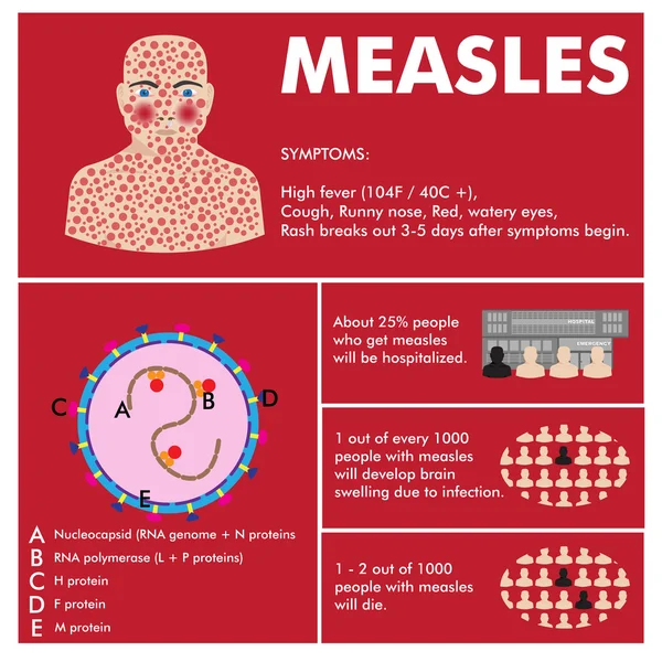 Vector measles infographic — Stock Vector