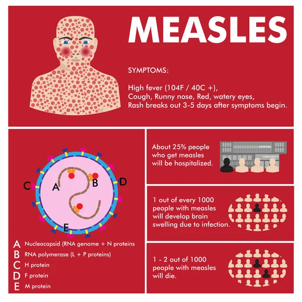 Infografía del sarampión vectorial — Vector de stock