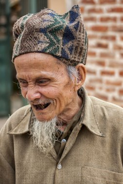 Eski Vietnamlı son derece kötü dişli.