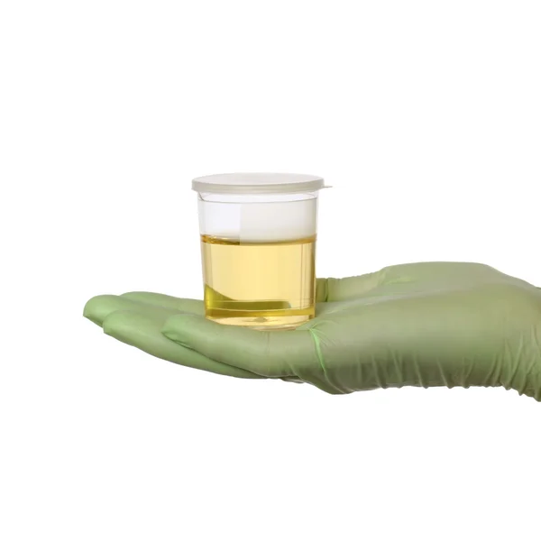 Urine sample in bottle, medical exam — Stock Photo, Image