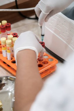 PRP prosedürü için kan tüpünden plazma örneği alan hemşire ya da doktoru kapatın - trombosit zengini plazma yenilenmesi tedavisi